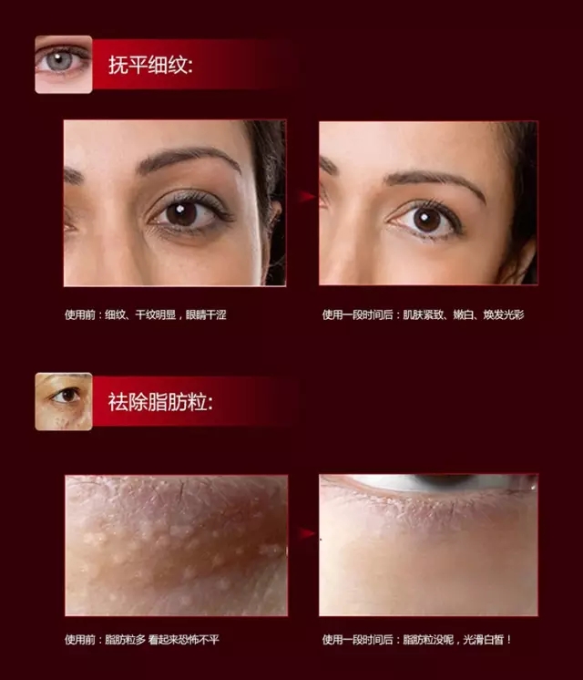 测评伊思眼霜是否真的让你回购,伊思眼霜效果怎么样