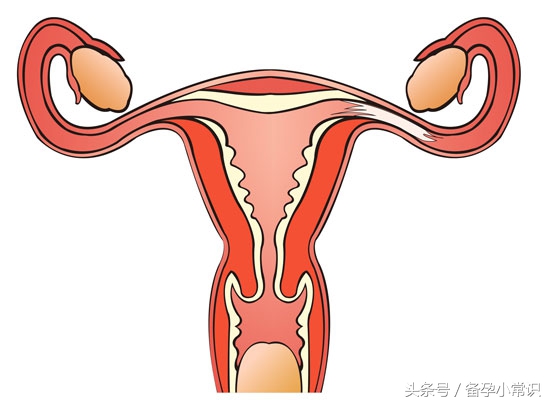 输卵管积液要怎样好得快,输卵管积液怎么处理是最好的
