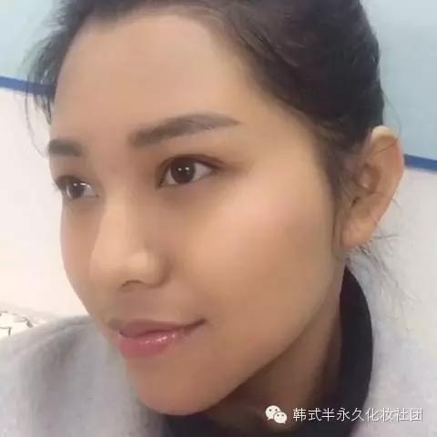 纹美瞳线七天脱痂过程图,纹美瞳线掉痂后反色过程图