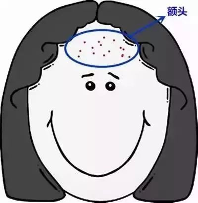 郑爽屏幕前貌美如花，幕后满脸痘花，明星都被坑的痘痘该怎么治？