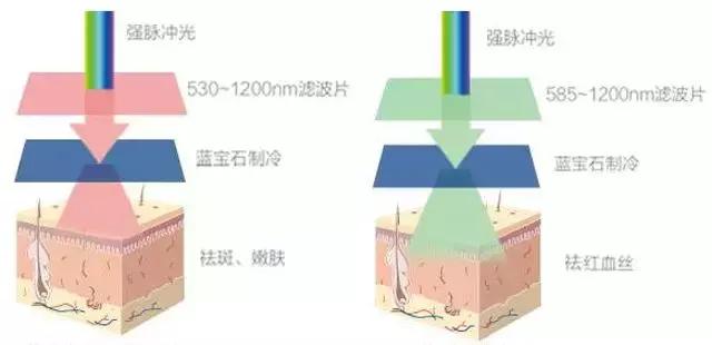 桃树褐斑穿孔病治疗方法,褐斑可以激光治疗吗