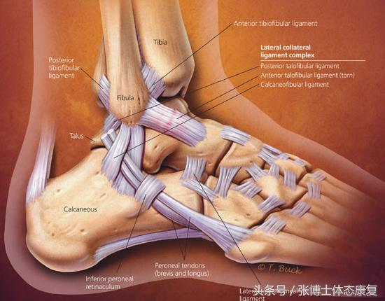 运动脚崴伤怎么快点恢复,运动损伤康复脚踝扭伤处理