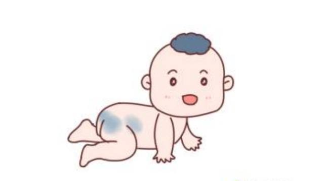 新生儿护理，宝宝身上有这些异样并非是病，爸妈们不必担心