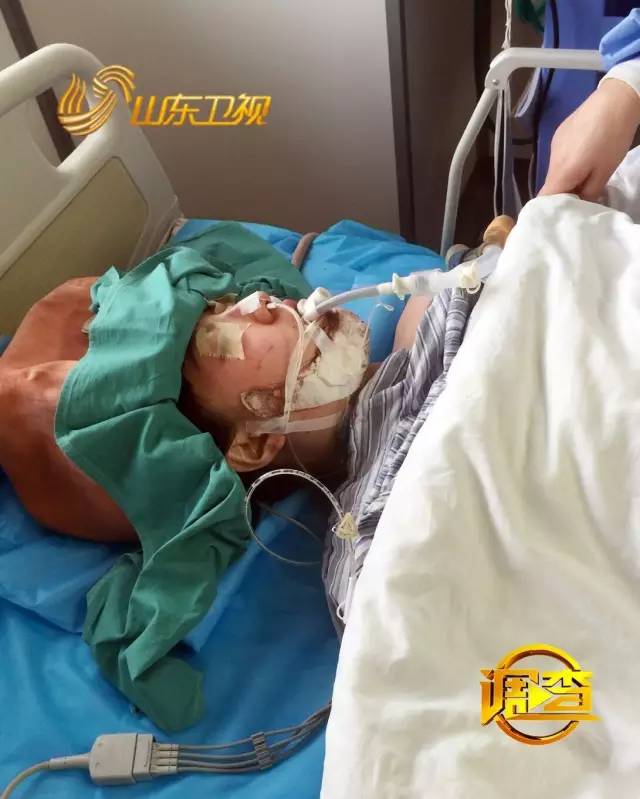 女海归削骨整形,女子做削骨整容七年断崖式衰老