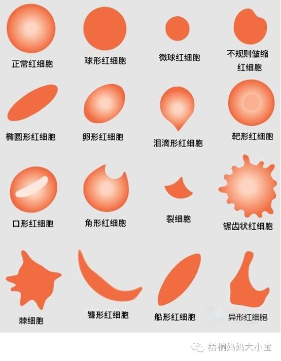 宝宝血色素正常值是多少,贫血血色素低是什么原因造成的