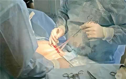 细数剖腹产对产妇和宝宝的13大危害！原来剖腹产才会阴道松弛！