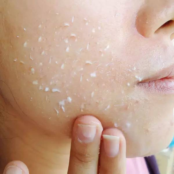 怎么去角质最简单实用的方法,怎样去角质的正确方法