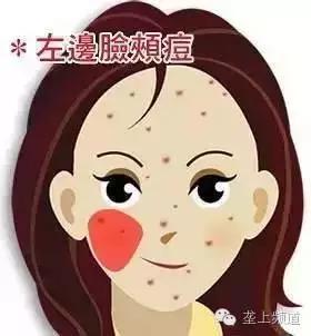 脸上长痘痘可以用醋洗脸吗,用醋洗面会长痘