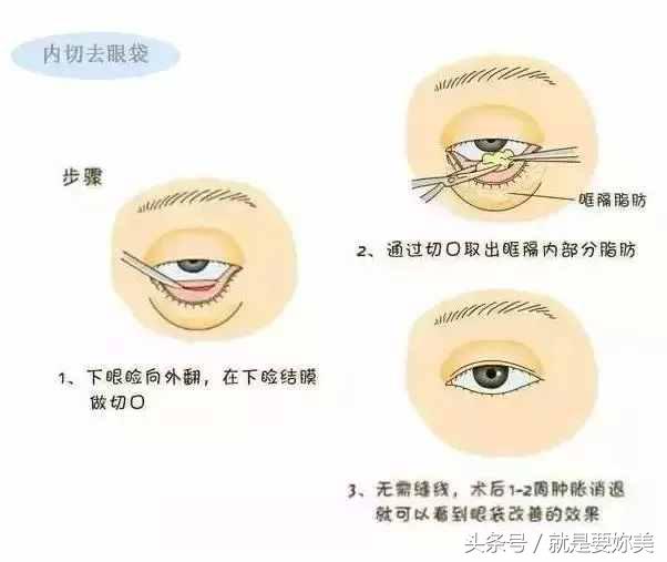 为什么坚持用护肤品却没效果,用眼霜去眼袋越来越大的原因