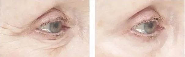 超好用面膜不过敏纯植物推荐,全网公认最好面膜不带货