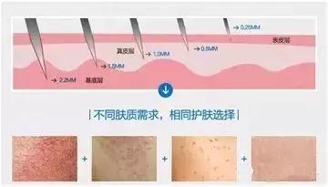 李沁活动把自己P白了N个度，这种肤色不均是不是没救了？