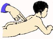 小儿推拿退烧最快方法穴位,小儿退烧的最有效穴位推拿