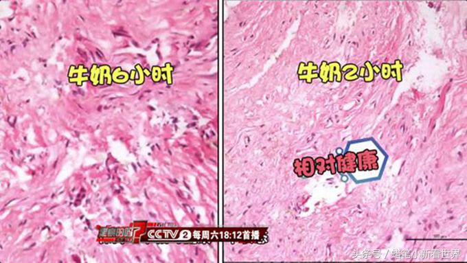 牙齿外伤撞掉多久可以种植,如果牙齿被撞掉的话还可以长出来