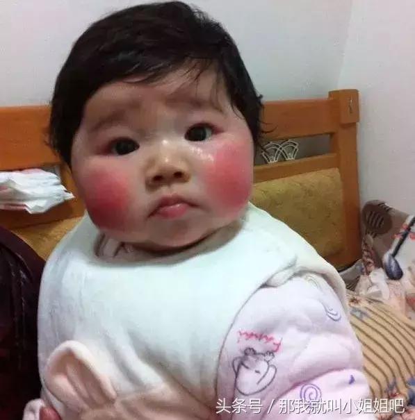 宝宝秋冬季红脸蛋的原因,宝宝秋冬红脸蛋怎么回事