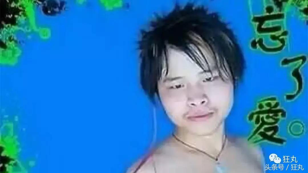 日本研究秃顶,日本教授秃头研究