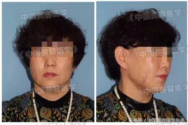 解放军医院治烫伤,解放军医院烧伤特效药