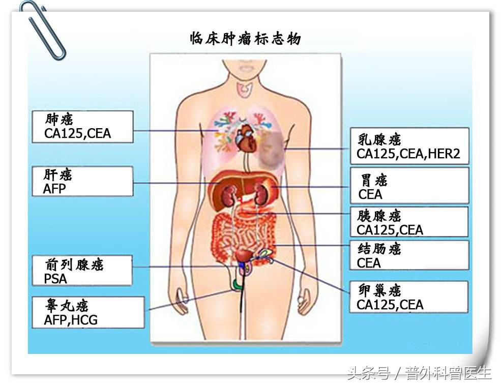ki6710%是良性肿瘤还是恶性肿瘤,良性肿瘤和恶性肿瘤区别有哪些