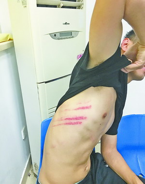 五名打人球员被开除足协与警方展开调查