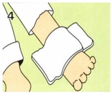 疼！家长们注意：熊孩子这样玩，钢丝刺穿右手中指！