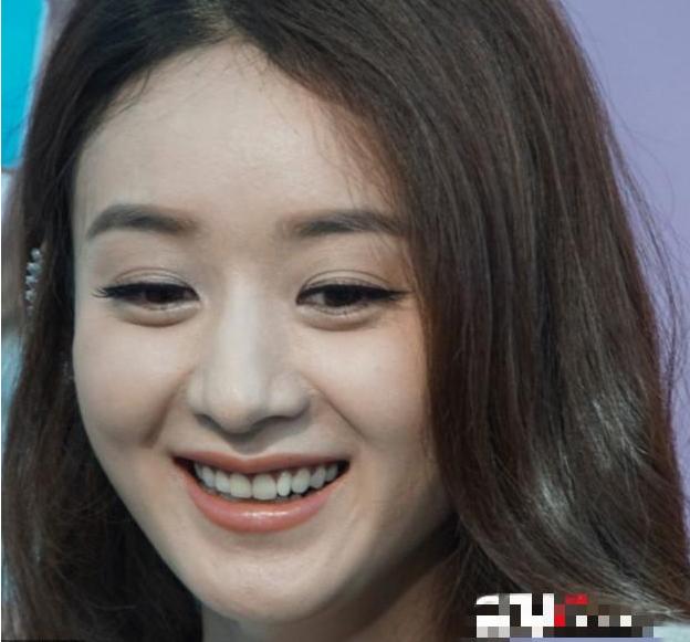 女明星都用双眼皮贴,为什么女明星用双眼皮贴