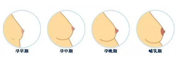 孕期胸部胀痛减轻正常吗,孕期怎样缓解胸部胀痛感