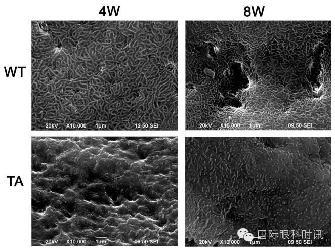 角膜会2016李炜教授:EDA基因突变鼠:一种新的睑板腺功能障碍相关性干眼动物模型