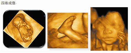 孕期羊水干货知识大全,孕妈妈产检资料收纳册