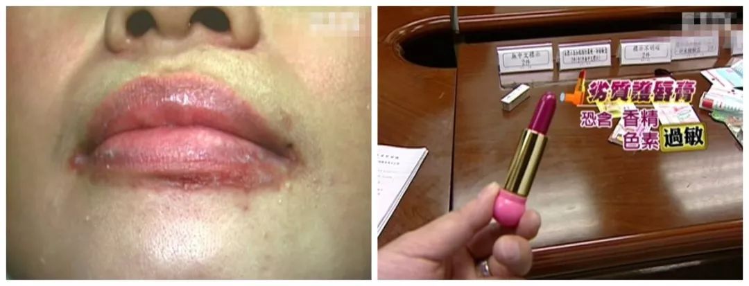 寰晢鍙g孩鐖嗘,涓嵂鎴愬垎鐨勬姢鑲ゅ搧寰晢