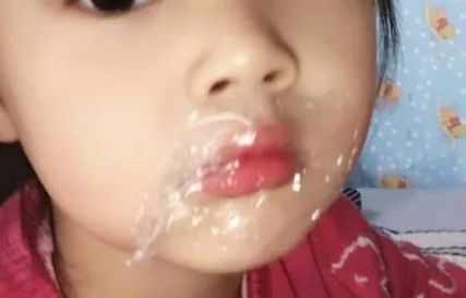 寰晢鍙g孩鐖嗘,涓嵂鎴愬垎鐨勬姢鑲ゅ搧寰晢