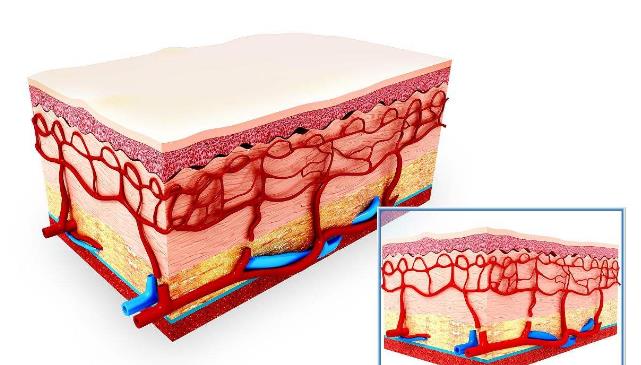 一个自然祛扁平疣的最好方法,有什么小妙招可以去除扁平疣