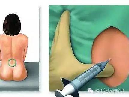 大s谈二胎难产的真实经历,大s爆出生二胎惊险过程