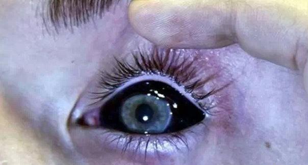 眼球刺青有什么含义,眼球里纹纹身