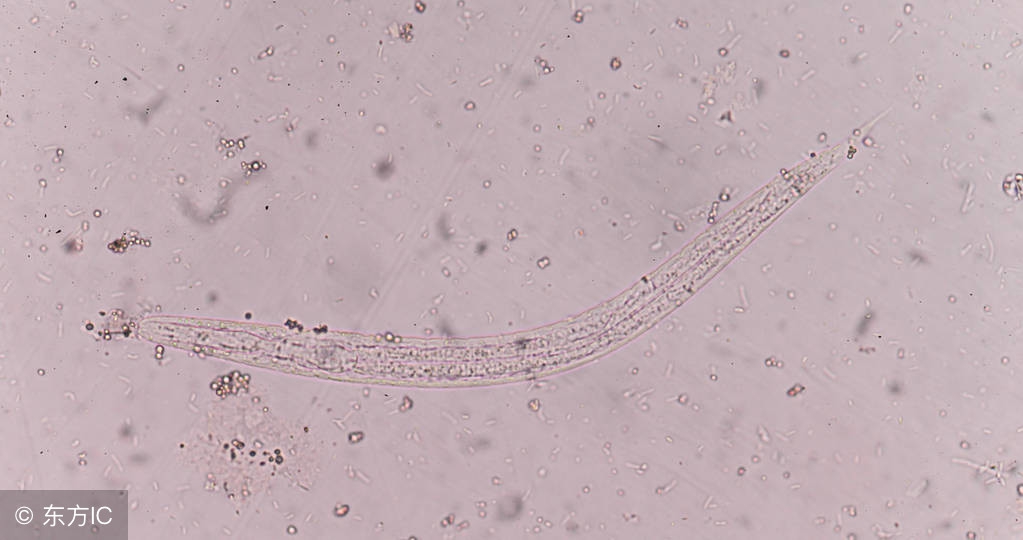 虫病蛲虫病,蛔虫蛲虫病用药