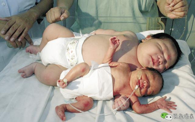 27岁妈妈不听医生劝说，拒绝剖腹产，生下12.5斤巨婴