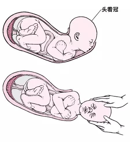 分娩过程中的三个产程过程,待产清单准妈妈们收藏起来