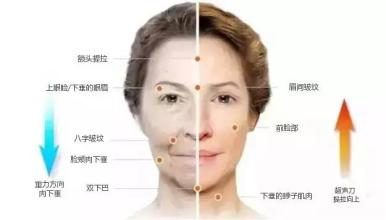 超声刀对抗岁月的神器,超声刀有哪些版本