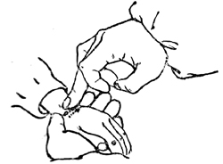 小儿推拿肠绞痛,小儿推拿肠胀