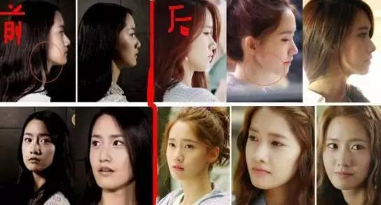 亚洲美神第一名，整形前居然是“男人”？