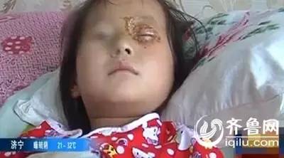 惊！祝生道具变伤人利器6岁女童被音乐蜡烛炸伤