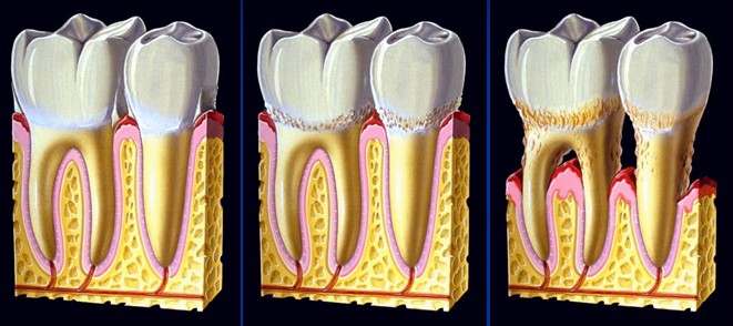 牙齿隐约痛医生怎么检查,牙齿疼马上看医生