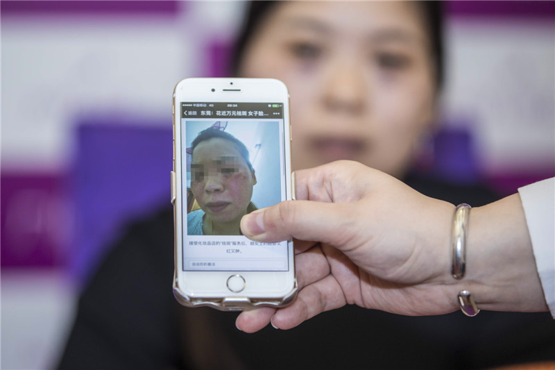 街边化妆店体验雀斑,化妆品店祛雀斑不用店内产品