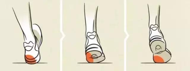 选鞋不当危害,适合内翻外翻的跑鞋