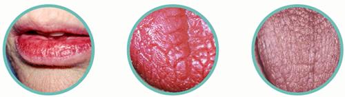 老人口干身上发热怎么办,老人夜里口干尿频怎么办