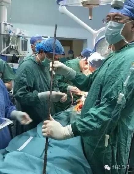 医学圈丨直径1.5厘米钢筋贯穿全身，男子如何闯过“鬼门关”？