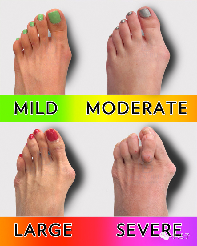 高跟鞋太高穿累脚怎么办,高跟鞋穿了不磨脚怎么办