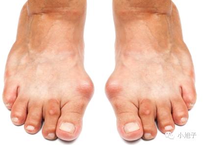 高跟鞋太高穿累脚怎么办,高跟鞋穿了不磨脚怎么办