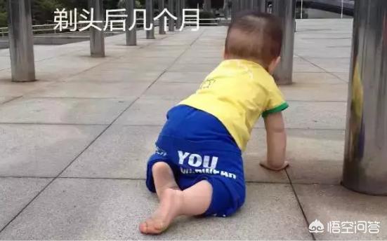 枕秃作为缺钙依据吗,小孩头发少或者枕秃是不是缺钙