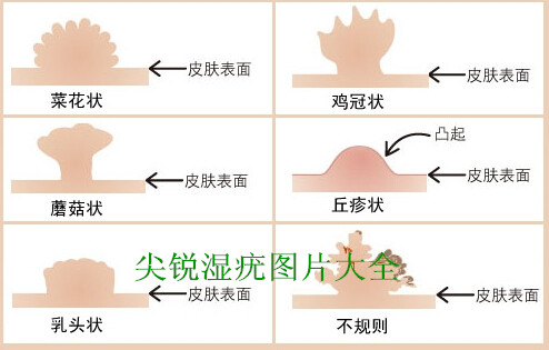 女性们请注意6种妇科病