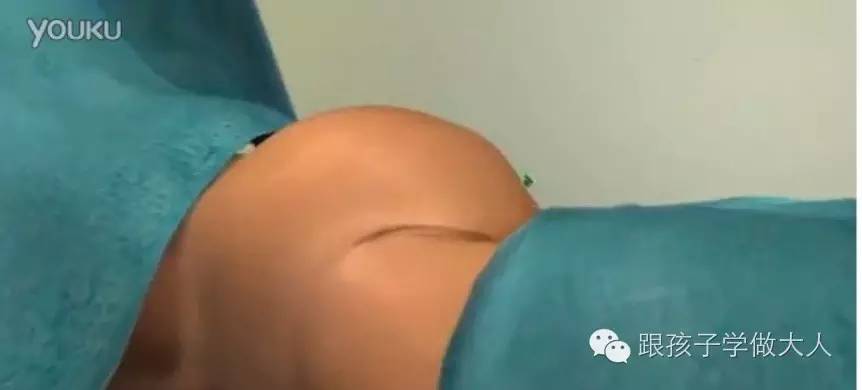 一些关于剖腹产的细节你知道多少,剖腹产最难的一个步骤