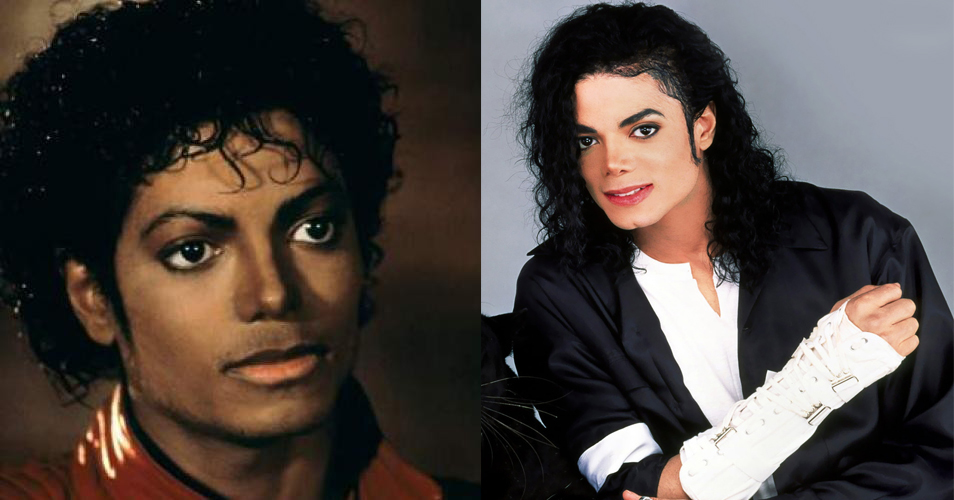 够买15辆最高配5系宝马！好莱坞明星整形整“疯”了